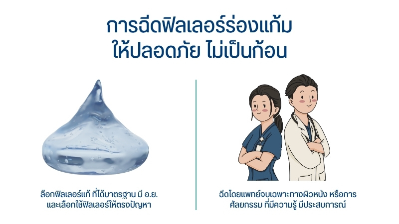 การฉีดฟิลเลอร์ร่องแก้ม ให้ปลอดภัย ไม่เป็นก้อน