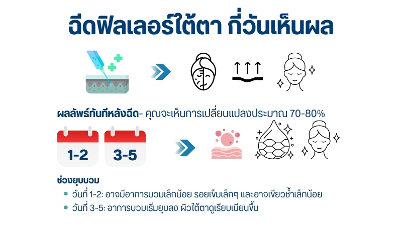 ฉีดฟิลเลอร์ใต้ตา กี่วันเห็นผล