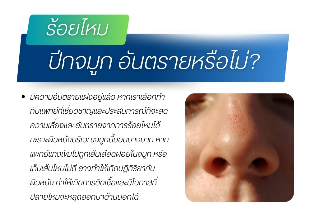 ร้อยไหมปีกจมูก อันตรายหรือไม่
