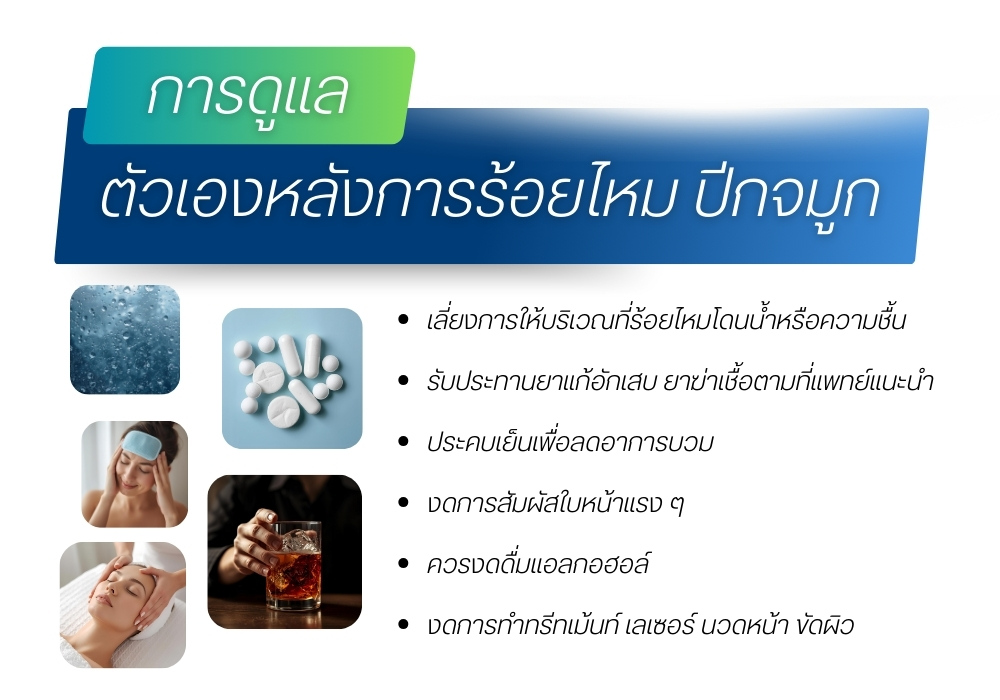 การดูแลตัวเองหลังการร้อยไหม ปีกจมูก