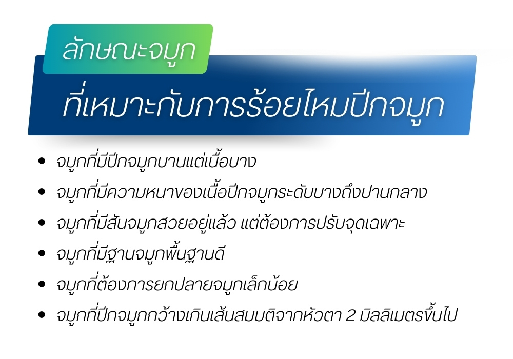 ร้อยไหม ปีกจมูก เหมาะกับรูปจมูกแบบไหน