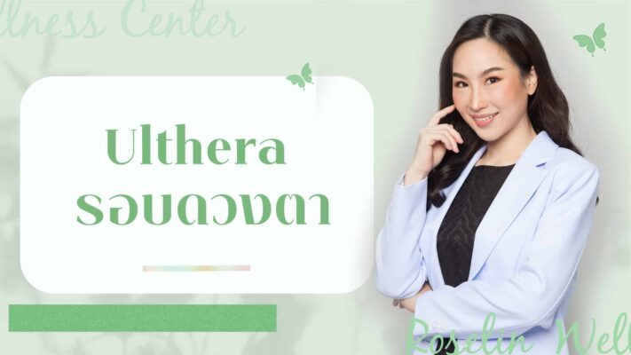Ulthera รอบดวงตา