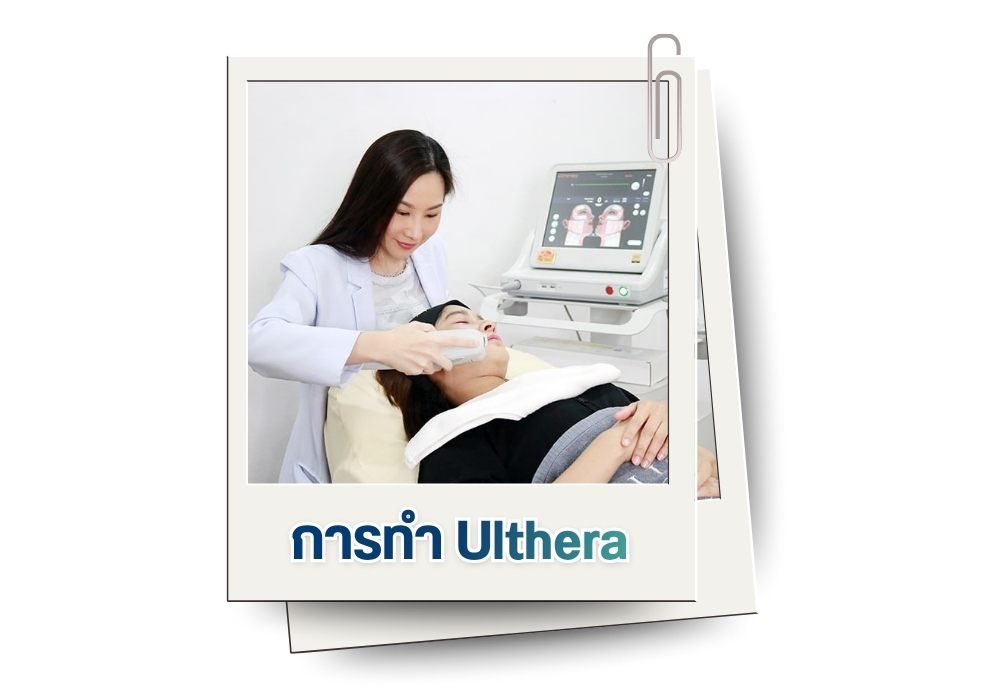 การทำ Ulthera