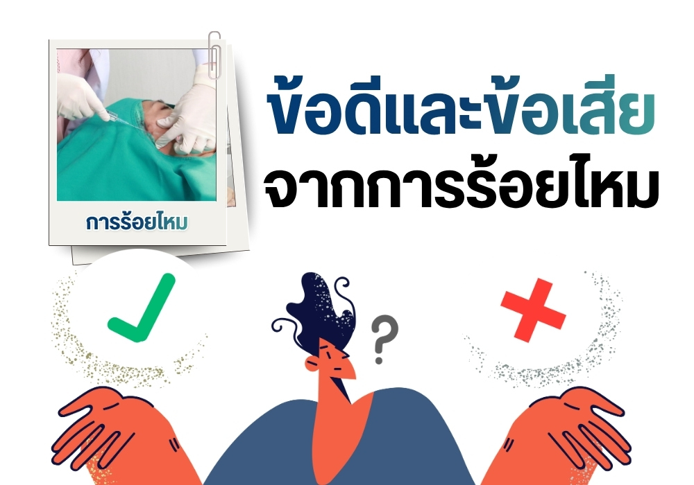 ข้อดีและข้อเสียจากการร้อยไหม
