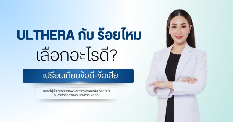 Ulthera กับ ร้อยไหม เลือกอะไรดี? เปรียบเทียบข้อดีข้อเสีย