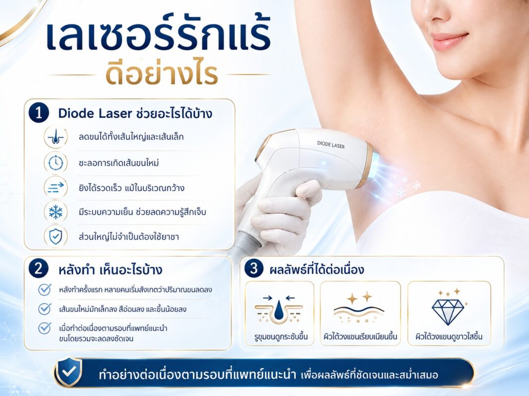 เลเซอร์รักแร้ ดีอย่างไร