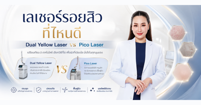 เลเซอร์รอยสิว ที่ไหนดี Dual Yellow Laser vs Pico Laser