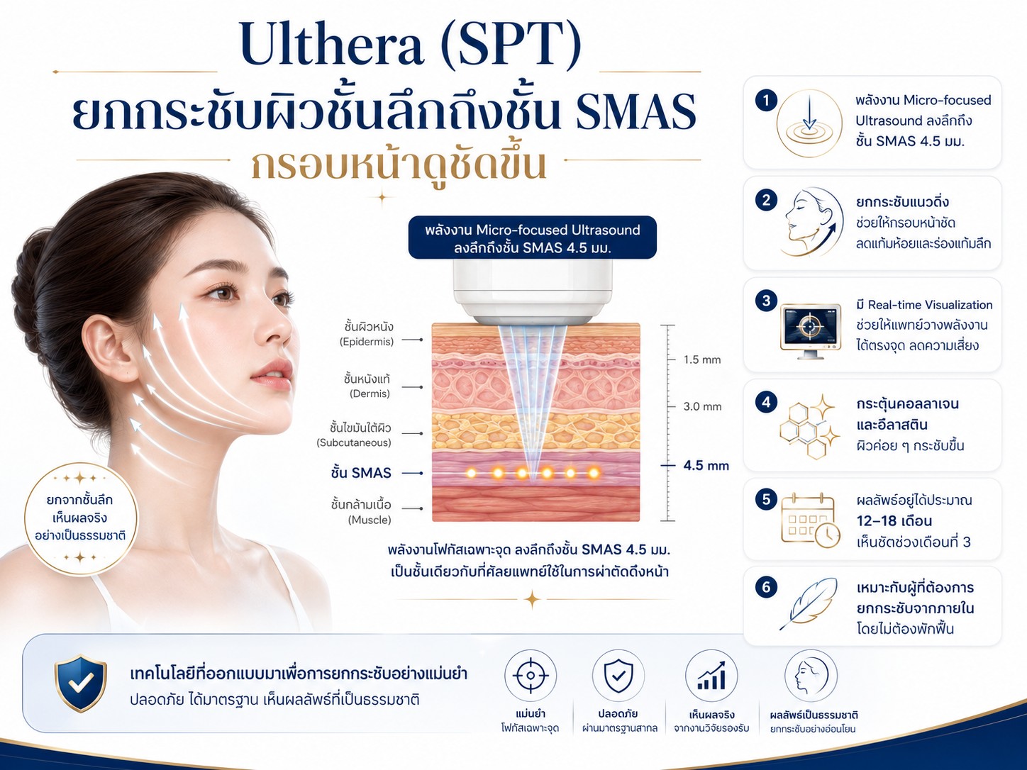Ulthera (SPT) ยกกระชับผิวชั้นลึกถึงชั้น SMAS กรอบหน้าดูชัดขึ้น