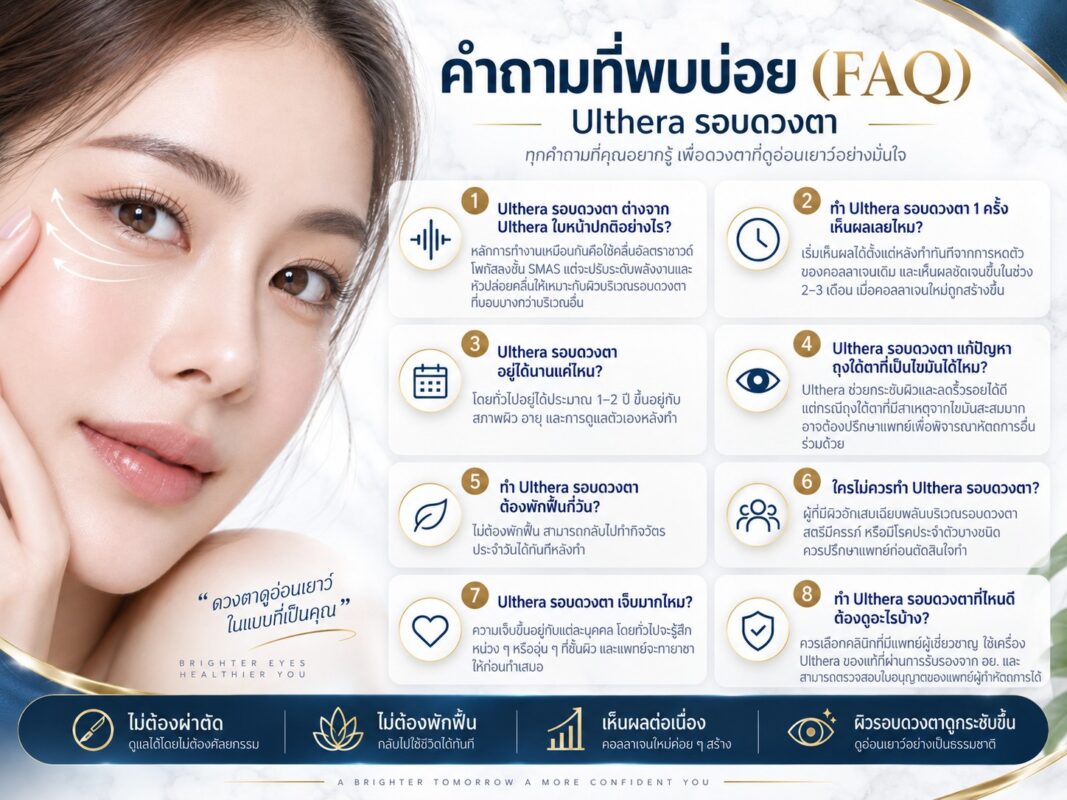 คำถามที่พบบ่อย (FAQ)