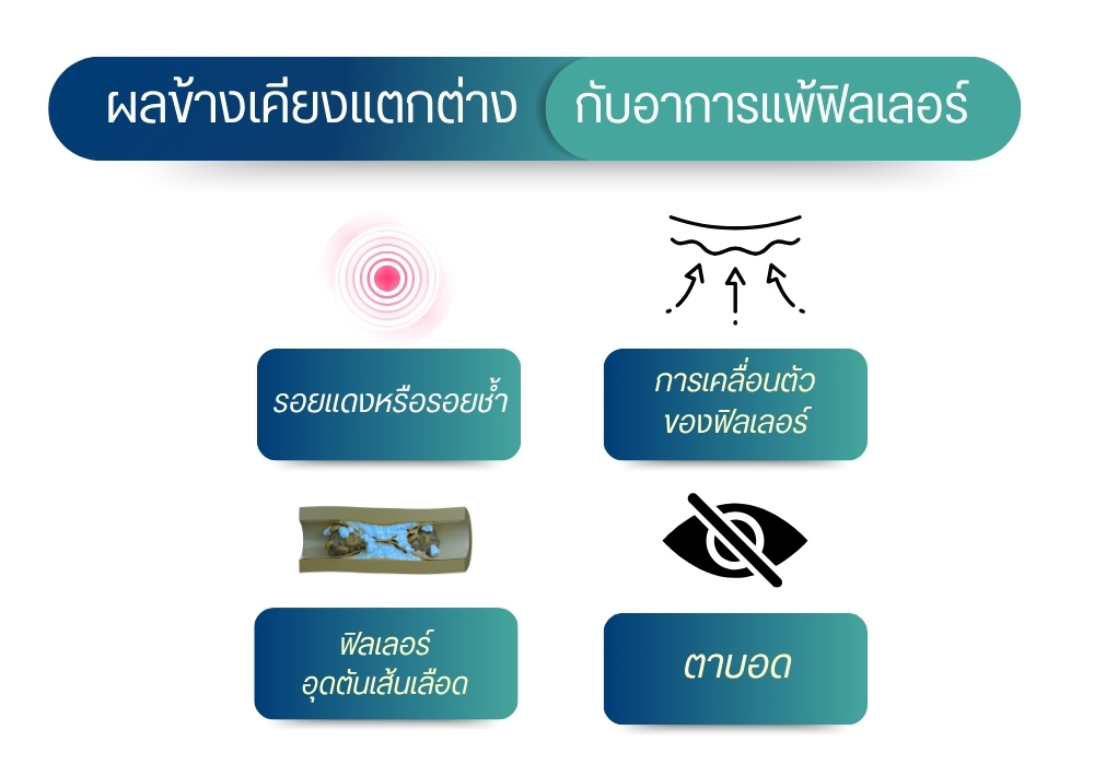 ผลข้างเคียงแตกต่างกับ อาการแพ้ฟิลเลอร์