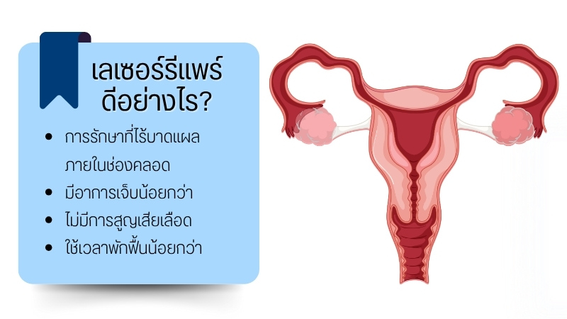 เลเซอร์รีแพร์ ดีอย่างไร
