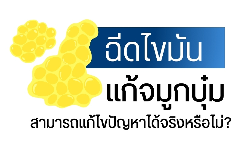 ฉีดไขมัน แก้จมูกบุ๋ม สามารถแก้ไขปัญหาได้จริงหรือไม่