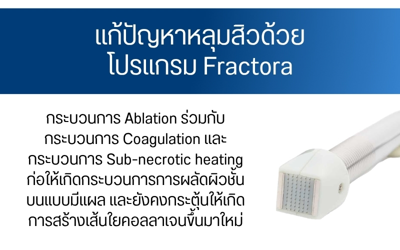 แก้ปัญหาหลุมสิวด้วยโปรแกรม Fractora