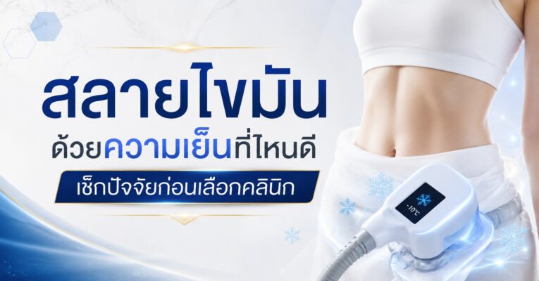 สลายไขมันด้วยความเย็นที่ไหนดี