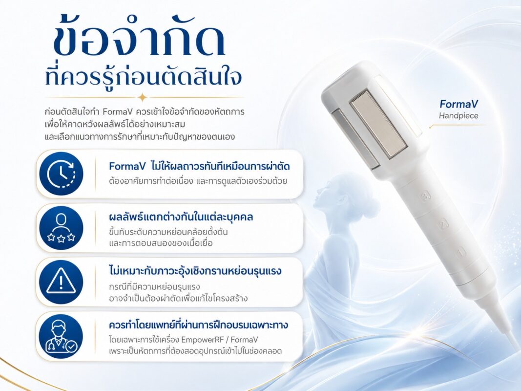 ข้อจำกัดที่ควรรู้ก่อนตัดสินใจ