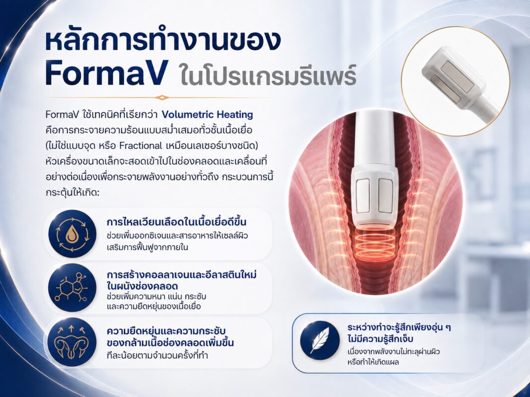 หลักการทำงานของ FormaV ในโปรแกรมรีแพร์