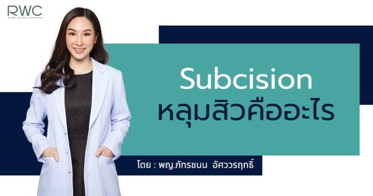 subcision หลุมสิว