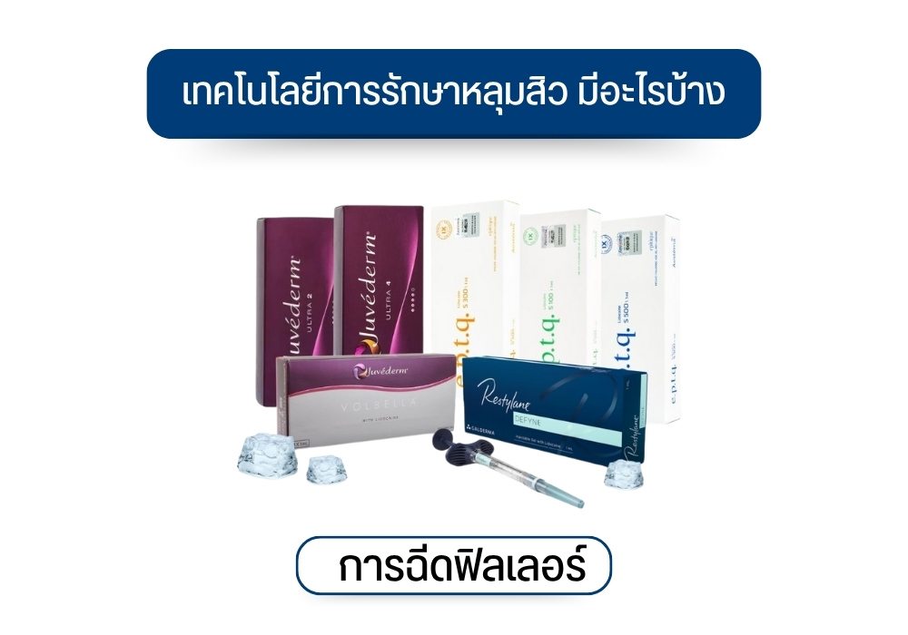 การฉีดฟิลเลอร์