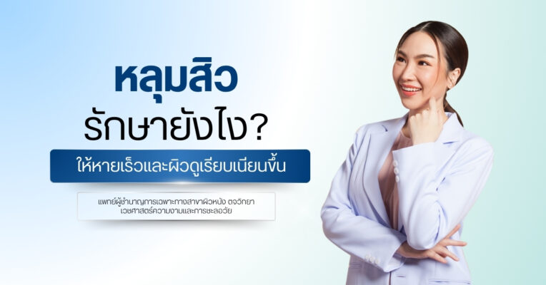 หลุมสิว รักษายังไง ให้หายเร็วและผิวดูเรียบเนียนขึ้น