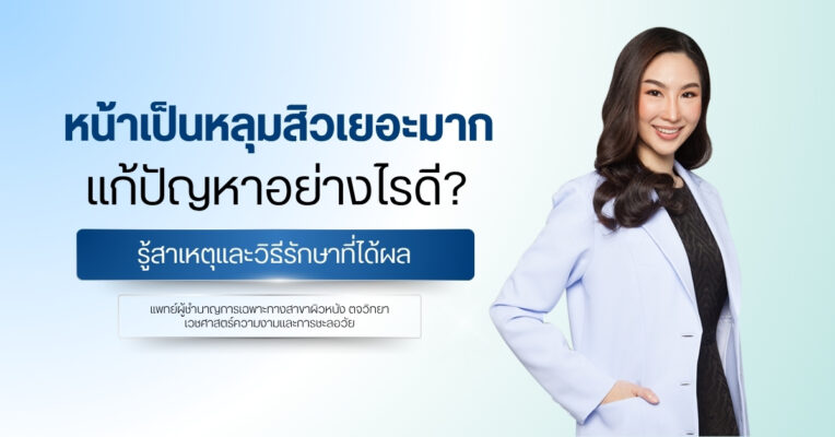 หน้าเป็นหลุมสิวเยอะมาก แก้ปัญหาอย่างไรดี? รู้สาเหตุและวิธีรักษาที่ได้ผล