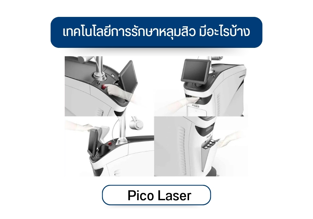 Pico Laser