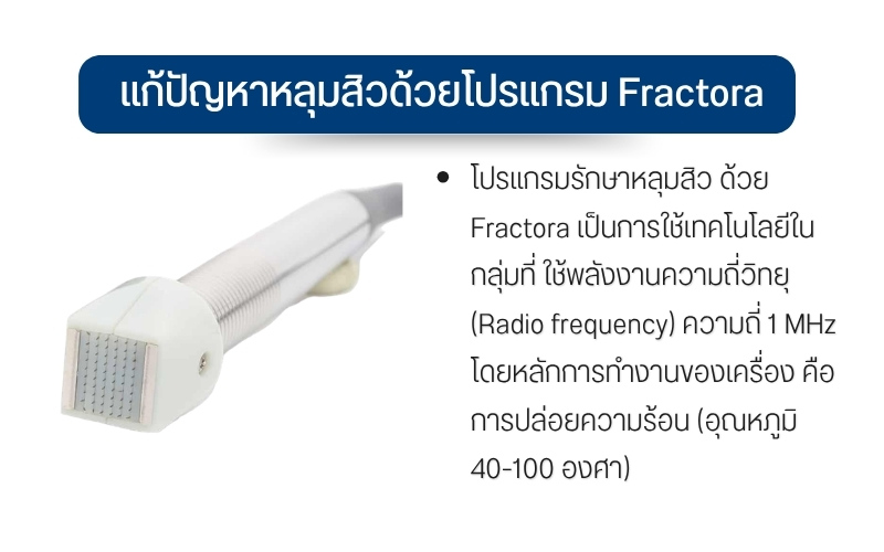 แก้ปัญหาหลุมสิวด้วยโปรแกรม Fractora