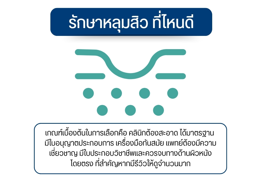 รักษาหลุมสิว ที่ไหนดี
