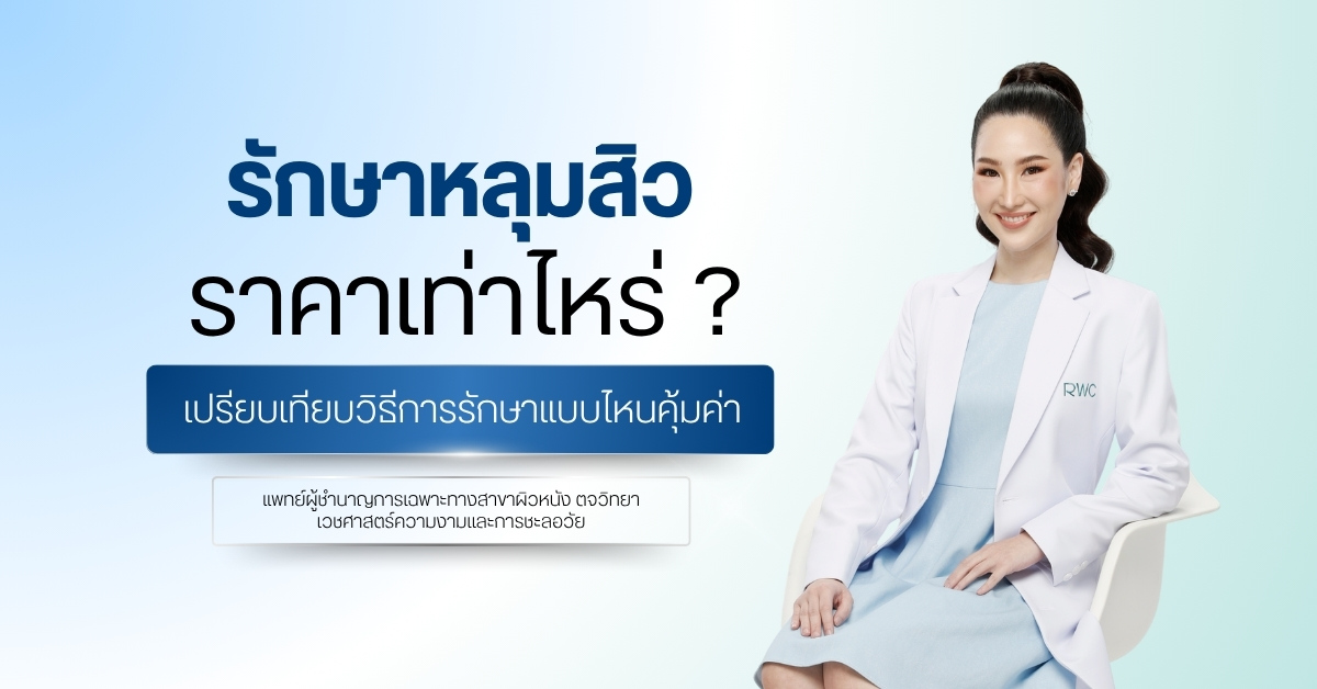 รักษาหลุมสิว ราคาเท่าไหร่