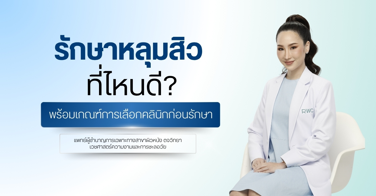 รักษาหลุมสิว ที่ไหนดี พร้อมเกณฑ์การเลือกคลินิกก่อนรักษา