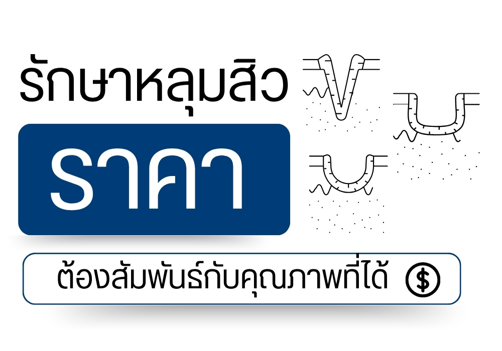 รักษาหลุมสิว ราคา ต้องสัมพันธ์กับคุณภาพที่ได้