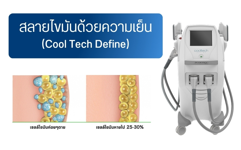 สลายไขมันด้วยความเย็น (Cool Tech Define)