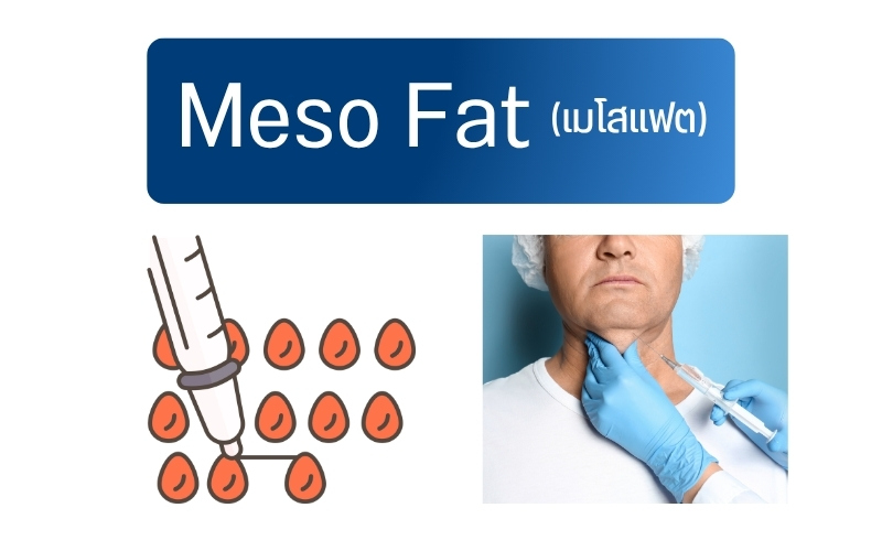 Meso Fat (เมโสแฟต)