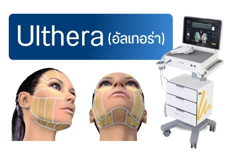 Ulthera (อัลเทอร่า)