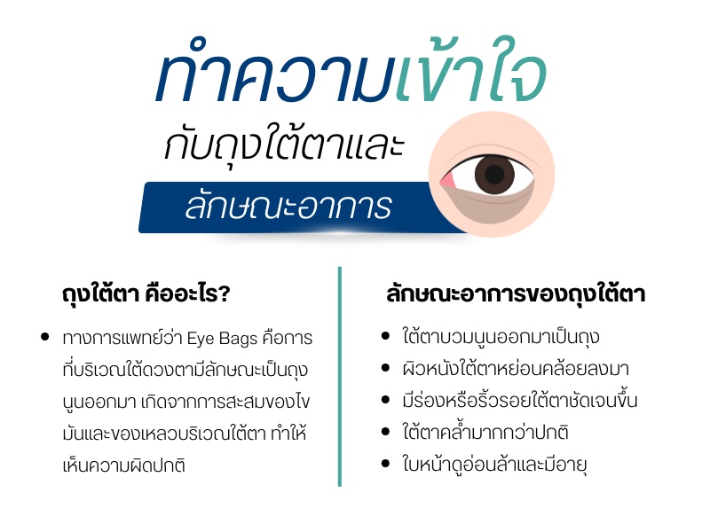 ทำความเข้าใจกับถุงใต้ตาและลักษณะอาการ