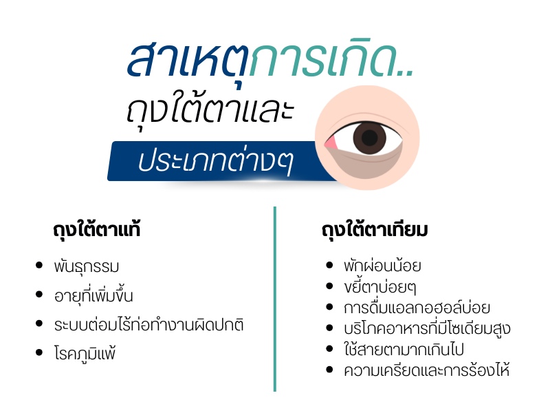 สาเหตุการเกิดถุงใต้ตาและประเภทต่างๆ