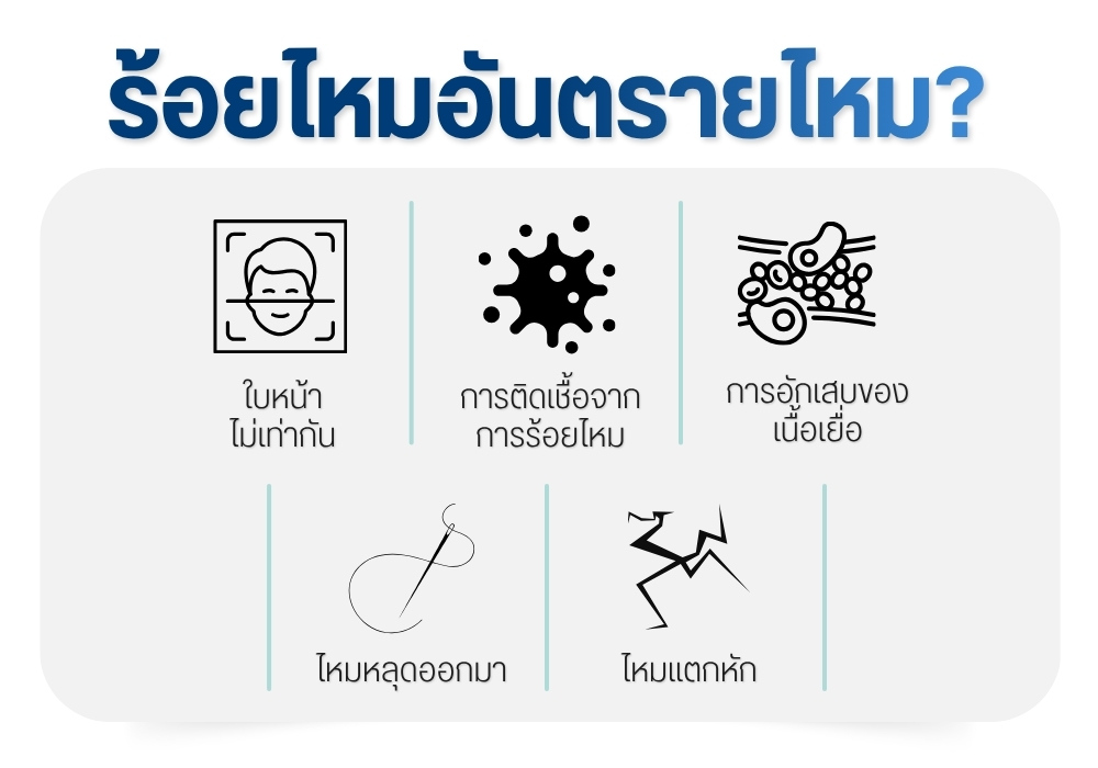 ร้อยไหมอันตรายไหม