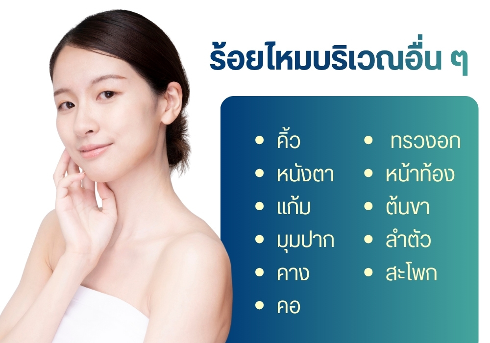 ร้อยไหมบริเวณอื่น ๆ 