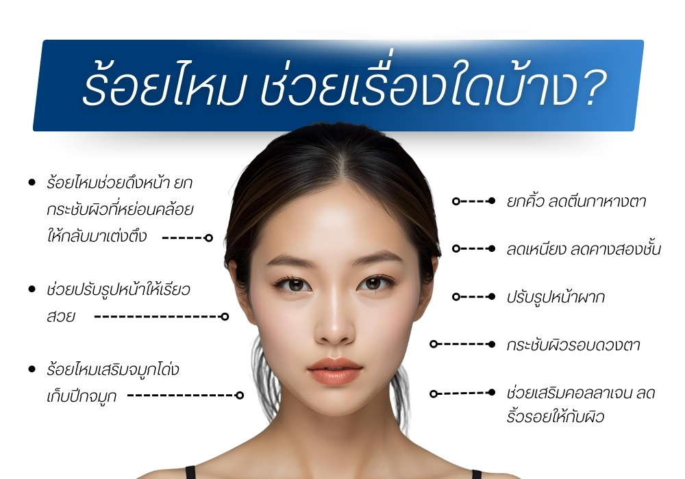ร้อยไหม ช่วยเรื่องใดบ้าง