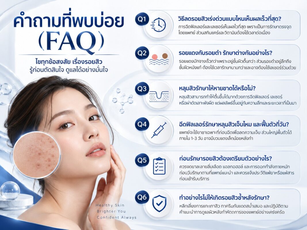 คำถามที่พบบ่อย (FAQ)