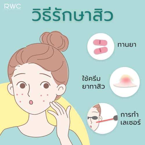 วิธีรักษาสิว รักษาสิว อย่างไรให้ได้ผลดี