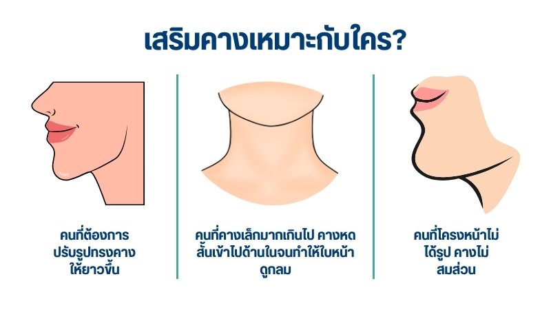 เสริมคางเหมาะกับใคร