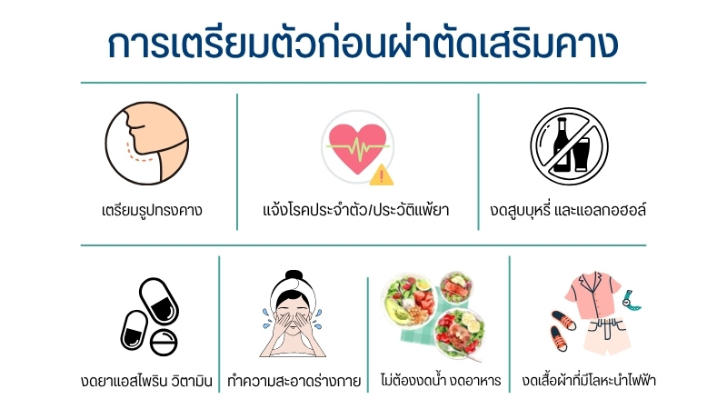 การเตรียมตัวก่อนผ่าตัดเสริมคาง