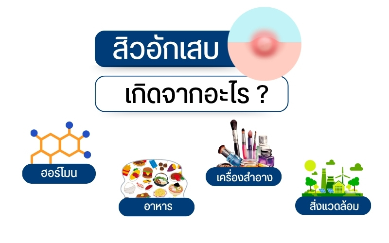 สิวอักเสบเกิดจากอะไร