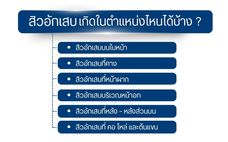 สิวอักเสบเกิดในตำแหน่งไหนได้บ้าง