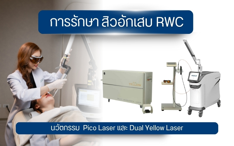 รักษาสิวอักเสบ RWC