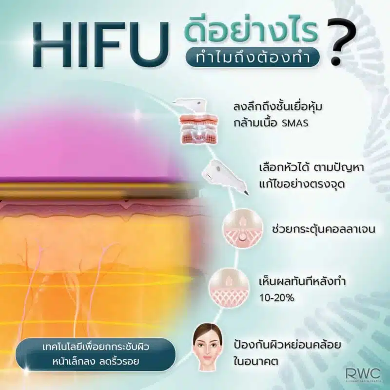 hifu ดีอย่างไร