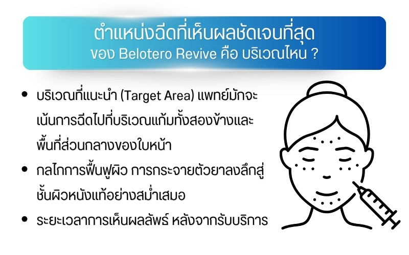 ตำแหน่งฉีดที่เห็นผลชัดเจนที่สุดของ Belotero Revive คือ บริเวณไหน ?