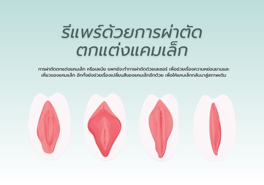 รีแพร์ มีกี่วิธี