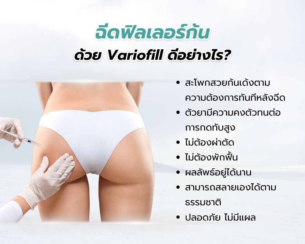 Variofill ดีไหม