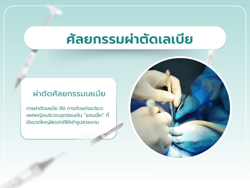 ผ่าตัดศัลยกรรมเลเบีย (Labiaplasty)